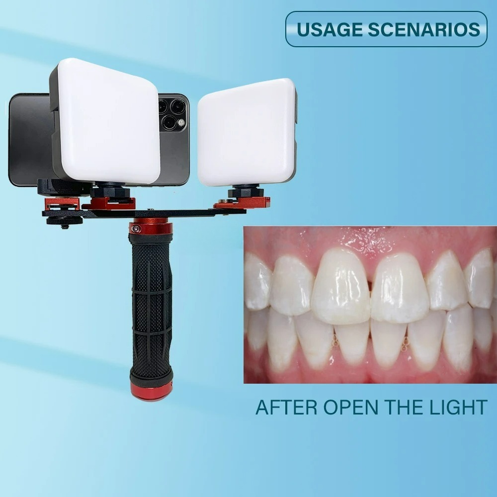 Dental Photography Light Phone - Photography Lighting Accessories recension och pris